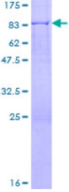 SDS PAGE (GSR-4404H).jpg